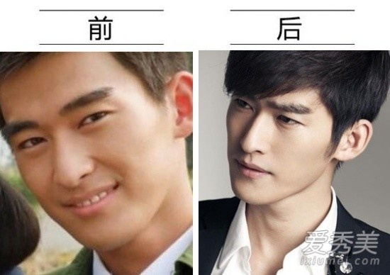 Sự nghiệp và ngoại hình của Trương Hàn đều thay đổi theo hướng tích cực theo thời gian. Khó có thể nhận ra đây từng là diễn viên bị chê xấu khi được nhận vai chính trong Vườn sao băng. Anh khiến nhiều người nghi ngờ việc chỉnh mũi.