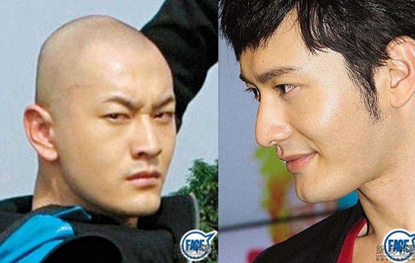 Huỳnh Hiểu Minh có cánh mũi cao thon hơn, đôi mắt to hơn và vùng cằm chẻ rất duyên. Trước nghi vấn thẩm mỹ, đặc biệt là độn cằm, anh luôn phủ nhận. Nhưng không vì thế mà tin đồn giảm bớt.