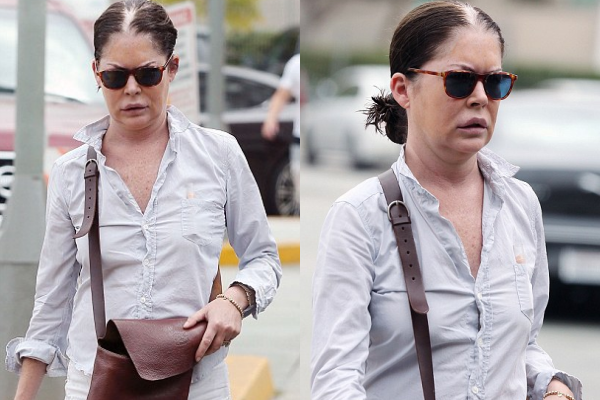 Lara ở tuổi 45 với gương mặt biến dạng.