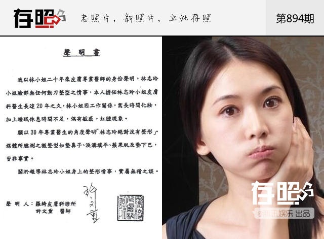 Lâm Chí Linh vào năm 2012 bị tung tin sử dụng botox, nâng mũi, và tiến hành hàng chục ca tiểu phẫu để giữ gìn nhan sắc. Trước thông tin này, cô bức xúc công bố kết quả kiểm tra tại viện da liễu, cho thấy người đẹp hoàn toàn là tự nhiên.