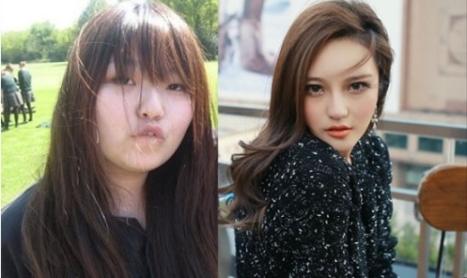 Châu Dương Thanh trước và sau khi thẩm mỹ.