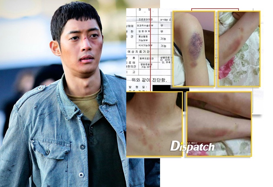 Kim Hyun Joong và bạn gái cũ kiện tụng.