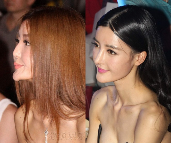 Hình ảnh Dĩnh Chi với chiếc cằm xô xệch vào năm 2014 (trái) và ảnh mới đây.