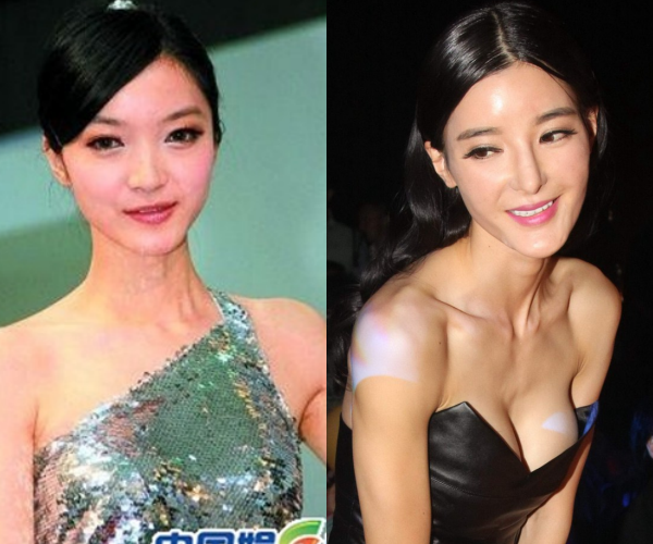 Lý Dĩnh Chi khi mới gia nhập showbiz với gương mặt mộc mạc và hình ảnh hiện thời. Cô bị chỉ trích lạm dụng thẩm mỹ nhiều năm.