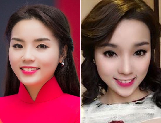 Trong những bức ảnh cũ có thể thấy ngay khuôn mặt đầy đặn của HH Kỳ Duyên còn hiện tại cằm cô dài trông thấy.