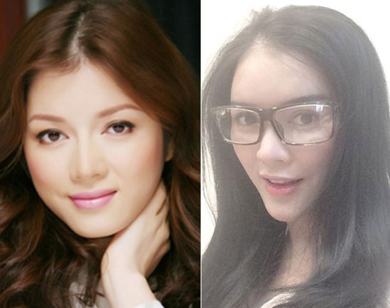 Chiếc cằm nhọn hoắt