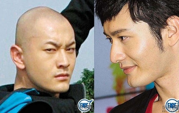 Huỳnh Hiểu Minh cho biết anh từng bị tai nạn xe, sau đó phải khâu cằm. Kết quả may mắn lại sở hữu chiếc cằm như ý.