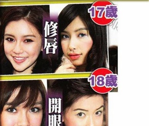 Ngay từ khi gia nhập showbiz cô đã bị đặt nghi vấn thẩm mỹ.