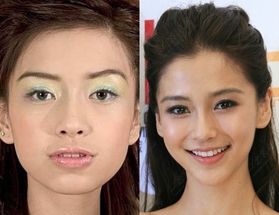 Cô cho biết chỉ thẩm mỹ niềng răng, sự khác biệt về hình ảnh theo thời gian là điều tự nhiên.