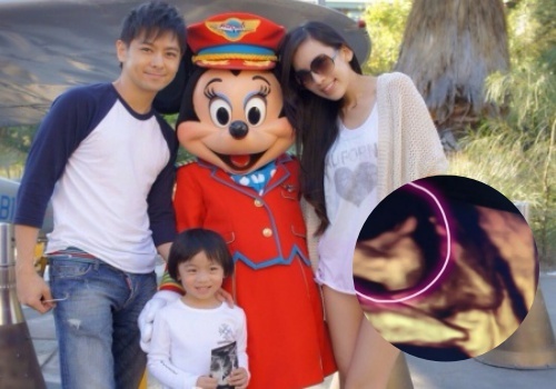 Lam Chi Dinh cong khai anh sieu am song thai hinh anh