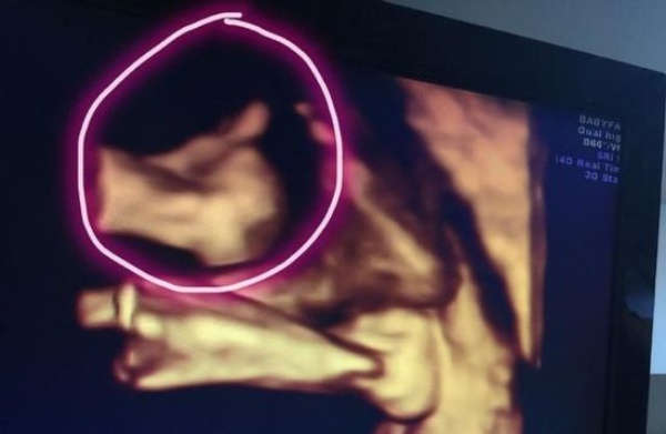 Phim siêu âm 4D của hai nhóc tì sắp chào đời nhà Lâm Chí Dĩnh.