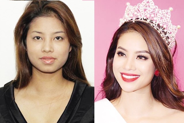 Sự thay đổi về gương mặt của tân Hoa hậu Phạm Hương làm dấy lên nghi vấn về việc “lách luật” mà không cần phẫu thuật thẩm mỹ. Ảnh: TL