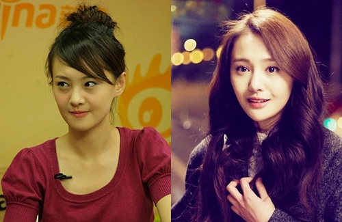 Trịnh Sảng trước (trái) và sau khi dao kéo