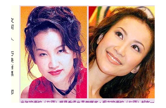 Có rất nhiều lời đồn thổi cho rằng nữ ca sĩ nổi tiếng Coco Lee là một người nghiện phẫu thuật thẩm mỹ và mỗi milimet trên cơ thể cô đều đã từng trải qua dao kéo. Quá mệt mỏi khi phải nghe thấy những tin đồn như vậy, cô đã lên tiếng: 