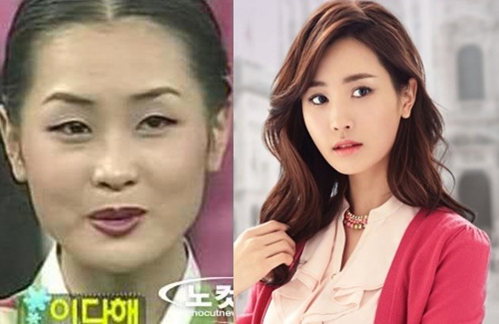 Lần đầu tiên Lee Da Hae xuất hiện trong ngành công nghiệp giải trí Hàn Quốc là khi  giành giải nhất tại cuộc thi sắc đẹp Chunhyang năm 2001. Sau khi vật lộn với một số vai phụ trong vài năm, nữ diễn viên đã có bước đột phá khi vai chính trong bộ phim My girl nhận được nhiều khen ngợi. Thế nhưng chính lúc này, người ta cũng phát hiện  ra khuôn mặt của Lee Da Hae đã thay đổi hoàn toàn khi chiếc mũi tẹt và đôi mắt một  mí đã biến mất. Trong khi tham gia vào một talkshow cách đây vài năm, cô đã khiến  nhiều người bất ngờ khi tự tin chia sẻ: 