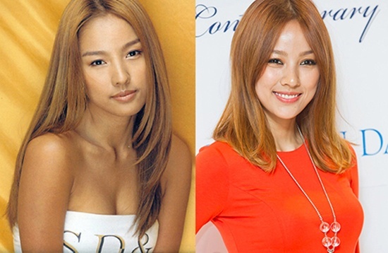 Mặc dù phẫu thuật thẩm mỹ đã trở thành một trào lưu rất phổ biến ở Hàn Quốc nhưng những thần tượng Kpop lại thường hay né tránh khi nói đến vấn đề này. Tuy vậy nữ hoàng Kpop là Lee Hyo Ri lại rất thành thật mỗi khi nhận được những thắc mắc về việc dao kéo của mình. Cách đây vài năm, nữ ca sĩ 36 tuổi đã chia sẻ kinh nghiệm của mình khi tiêm botox trong một talkshow. Cô cho biết đã tiêm một lần để loại bỏ những nếp nhăn trên mắt nhưng quyết định không làm thêm lần nữa vì cảm thấy khó khăn mỗi khi cười.