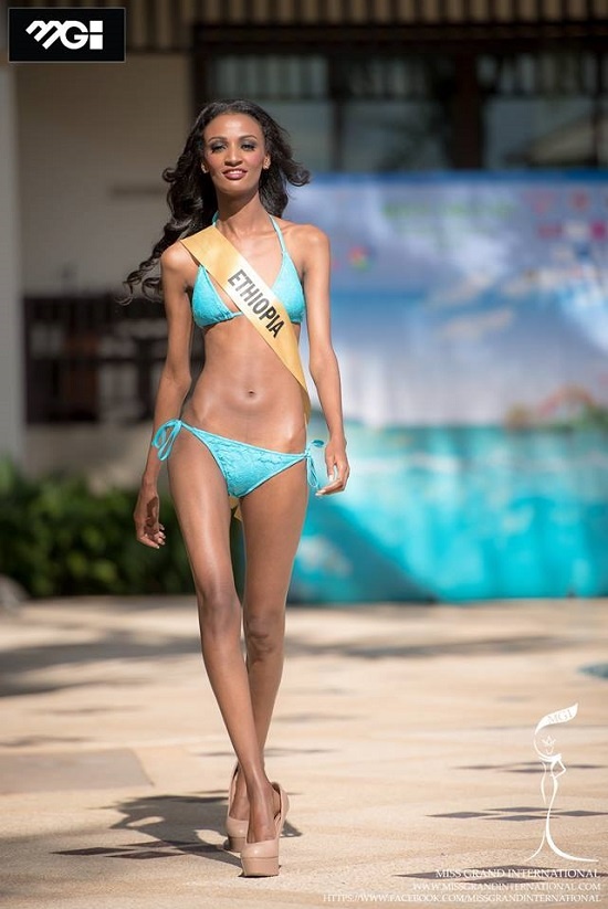 Hoa hậu Ethiopia với thân hình da bọc xương khiến dư luận xôn xao