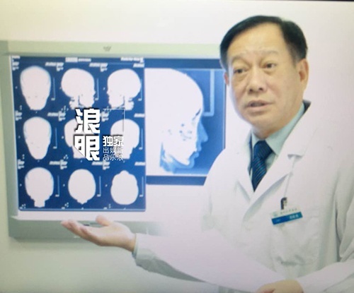 Viện trưởng Kỳ Tá Lương công khai kết quả chụp CT và đưa ra kết luận Angelababy không thẩm mỹ.