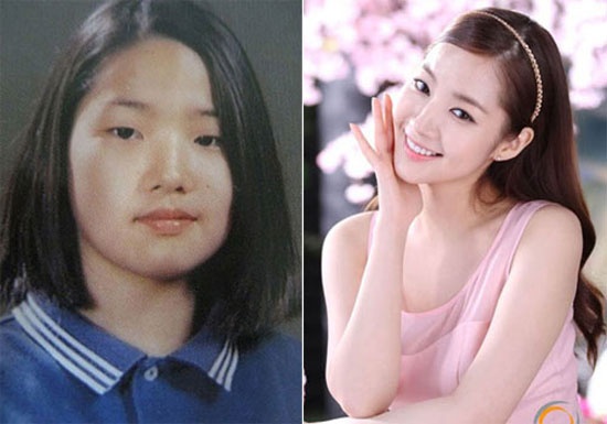 Park Min Young không ngần ngại thừa nhận phẫu thuật thẩm mỹ. Phải thừa nhận rằng, cô chỉnh sửa quá thành công.