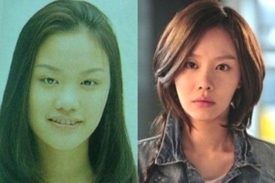 Kim Ah Joong trở thành mỹ nhân nhờ phẫu thuật thẩm mỹ.