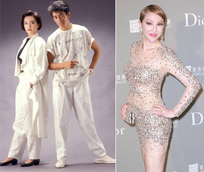 Tiết Chỉ Luân: Người đẹp một thời trở thành “thảm họa thẩm mỹ” từ gần 10 năm nay. Nhìn hình ảnh ngày ấy và bây giờ, khó tin rằng họ là một người.