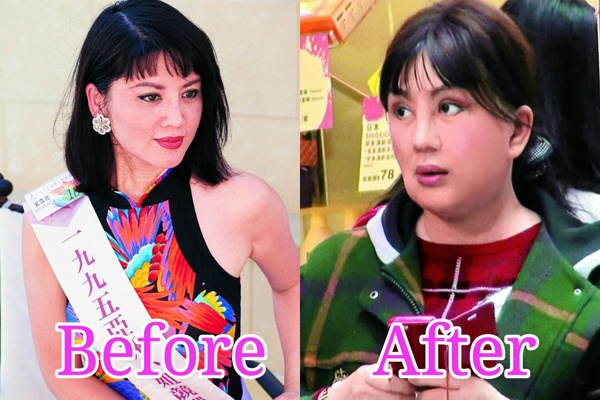 Cung Tuyết Hoa với gương mặt phù nề, biến dạng sau thẩm mỹ.Nữ diễn viên gạo cội từng lọt vào vòng chung kết Hoa hậu Hong Kong cho rằng cuộc đời bà sai lầm lớn nhất là từng thẩm mỹ.