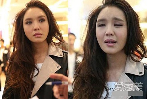 Quan Ân Na từng né tránh câu hỏi về chuyện có từng thẩm mỹ hay không. Nhưng gương mặt bị méo xệch của cô là bằng chứng cho thấy cô sai lầm khi đã bơm botox và chỉnh môi.