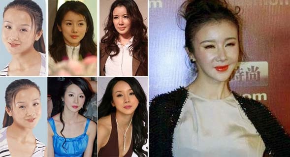 Tôn Phi Phi khi mới gia nhập làng giải trí có vẻ đẹp tự nhiên, không hoàn hảo nhưng cũng thuộc hàng tú nữ. Nhưng hình ảnh gần đây cho thấy, mặt cô sưng phù, môi biến dạng. Nhiều trang mạng cho rằng Tôn Phi Phi sai lầm khi đã thẩm mỹ