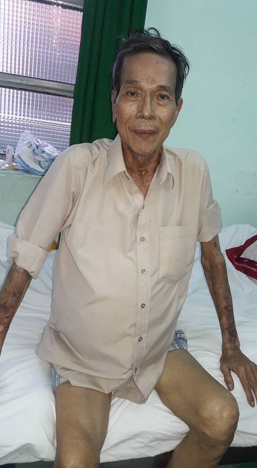 Bệnh tật khiến người nghệ sĩ già hốc hác hẳn đi