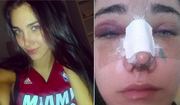 Tân Hoa hậu lộ ảnh thẩm mỹ trước khi đi thi.