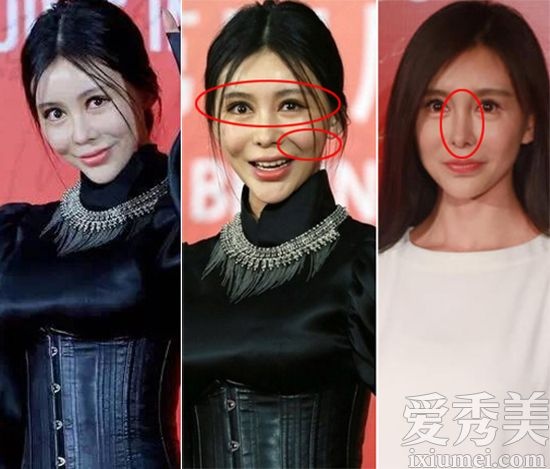 Củng Tân Lượng mất đi bạn trai, chịu hậu quả của thẩm mỹ. Cô thừa nhận đã rơi vào giai đoạn khó khăn khi đánh mât quá nhiều điều chỉ vì dao kéo.