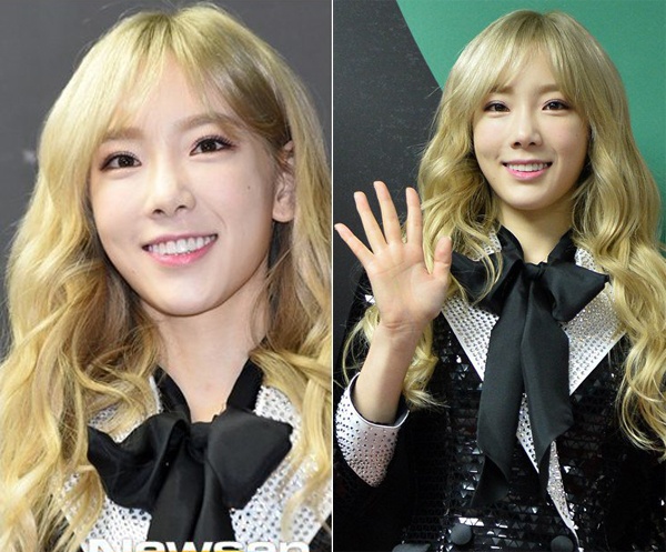 Trưởng nhóm Taeyeon với diện mạo được ví như búp bê. Tuy nhiên, nhiều ký giả nhận ra chiếc mũi lệch của nữ ca sĩ. Phần cánh mũi bên trái của Taeyeon nhỏ hơn bên còn lại. Giọng ca I từng vướng nghi vấn phẫu thuật thẩm mỹ gây xôn xao cách đây không lâu.