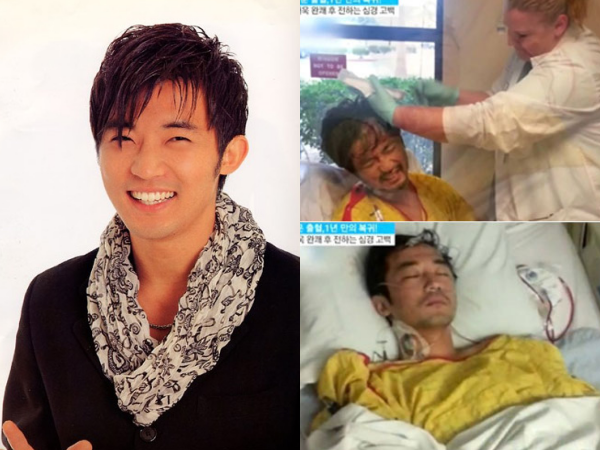 Ahn Jae Wook khi nằm trên giường bệnh (phải) và ảnh năm xưa.