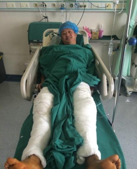 Anh từng chấn thương nặng cả hai chân