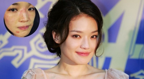 Thu Ky lo lang vi bi di ung 1 thang khong khoi hinh anh