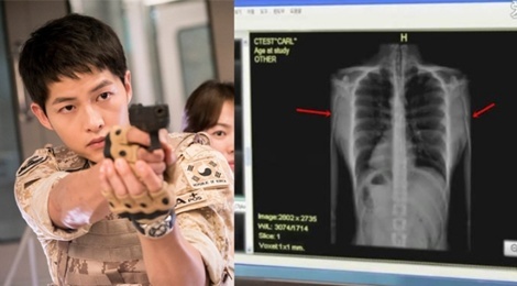 Nhung lo hong y hoc trong 'Hau due cua mat troi' hinh anh