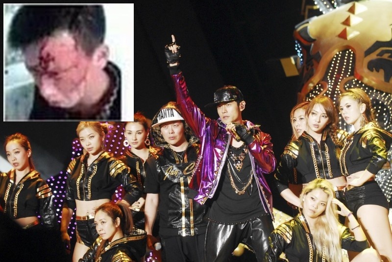 Châu Kiệt Luân và sự cố biểu diễn ảnh 1 Chau Kiet Luan va su co bieu dien anh 1