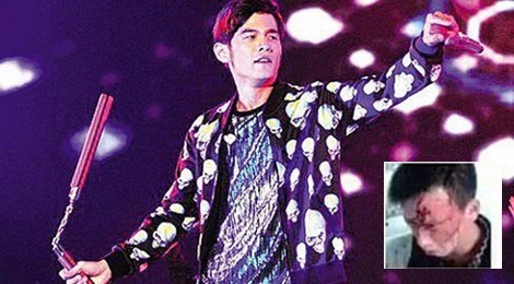 Chau Kiet Luan bi nghi khien fan chan thuong vi nem con hinh anh