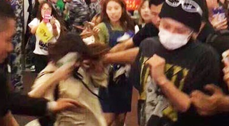 Fan bi xo nga khi co tiep can G-Dragon hinh anh