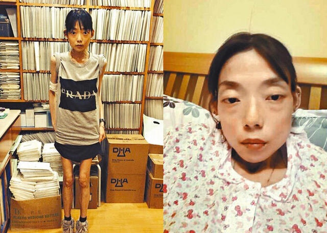 My nhan TVB Duong Ai Can ket hon anh 2