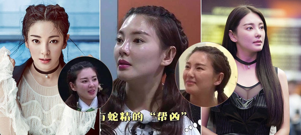 Trương Vũ Kỳ thẩm mỹ ảnh 2 Truong Vu Ky tham my anh 2