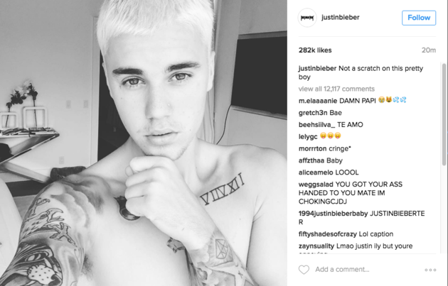 Justin Bieber đánh nhau ảnh 2 Justin Bieber danh nhau anh 2