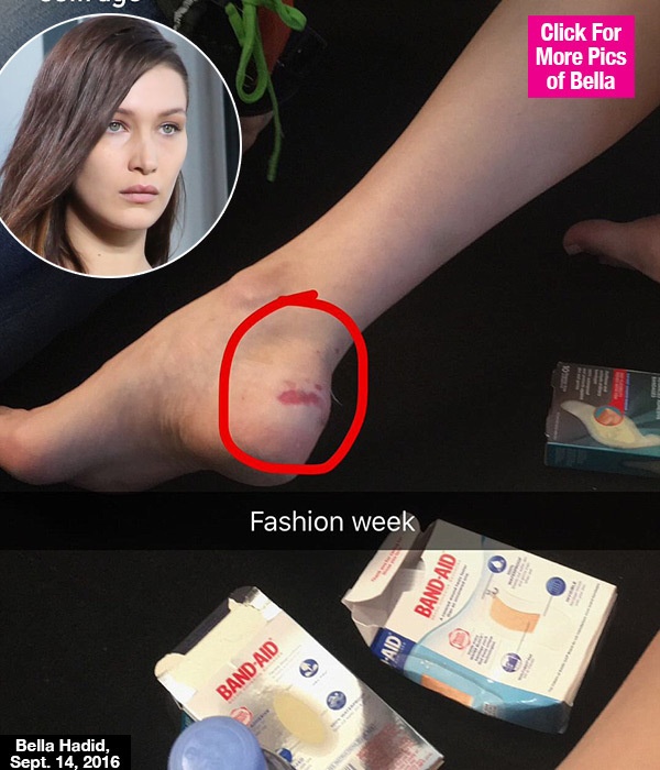 Bella Hadid bi nga tren san dien anh 8