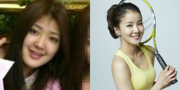 Sao nu Han phau thuat anh 2