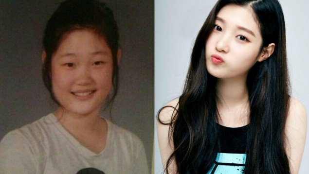 Loat sao nu Han thua nhan phau thuat tham my hinh anh