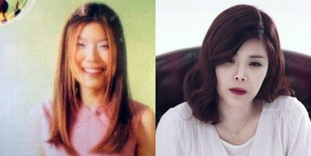 Sao nu Han phau thuat anh 5