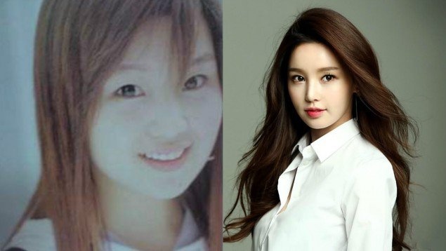 Sao nu Han phau thuat anh 6