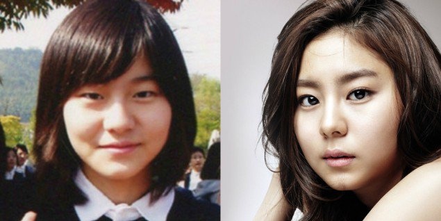 Sao nu Han phau thuat anh 7