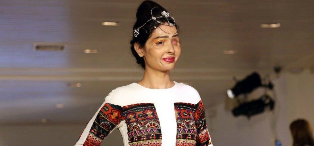 co gai An do bi tat axit anh 1