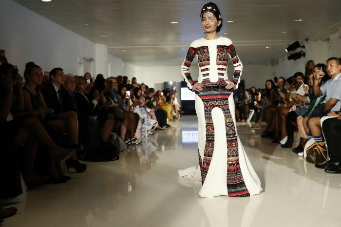 co gai An do bi tat axit anh 3